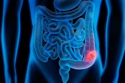 2018 Rectal Tumor Board (Occurs Weekly, Every Tuesday) Banner